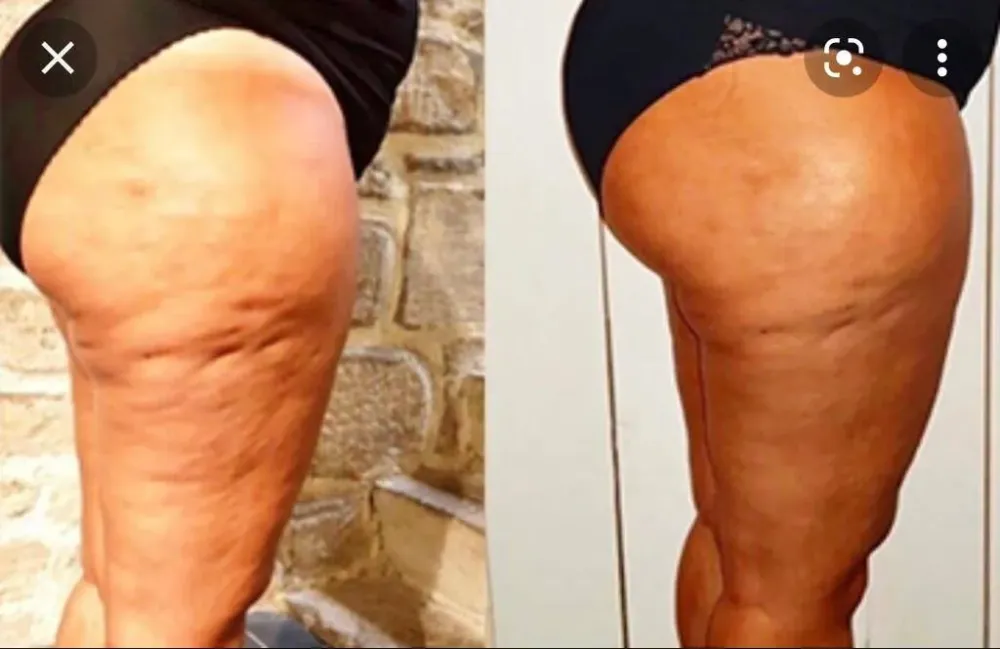 effets du Twin Slim