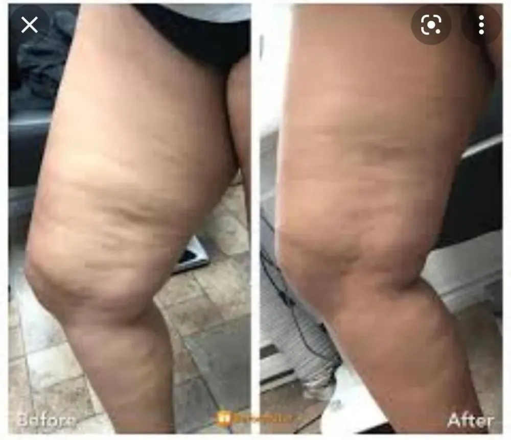 Slim