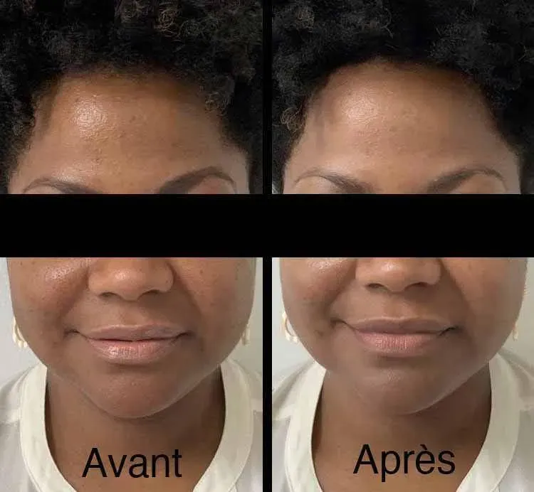 effet Jetpeel